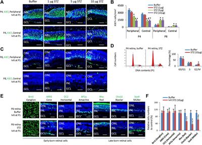 Hyperglycemia-independent neonatal streptozotocin-induced retinopathy (NSIR) in rats